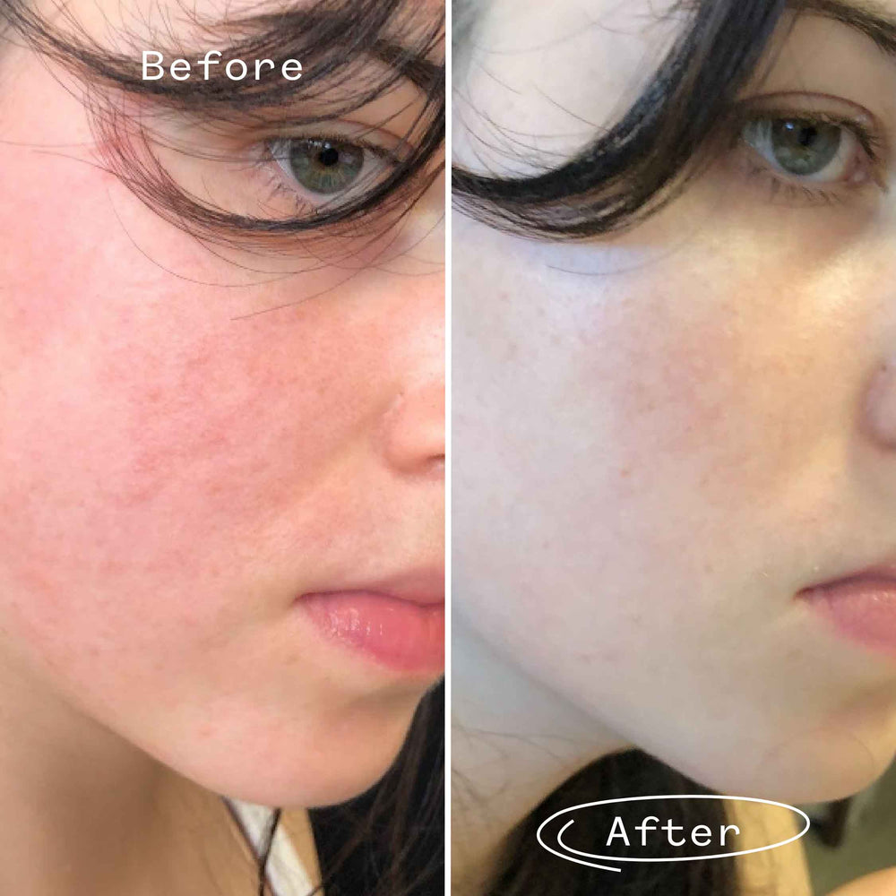 The Light Fantastic™ Face Oil