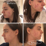 Instant Kalmer™ Serum