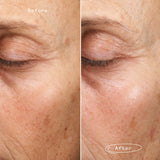 Fade Forward™ Serum