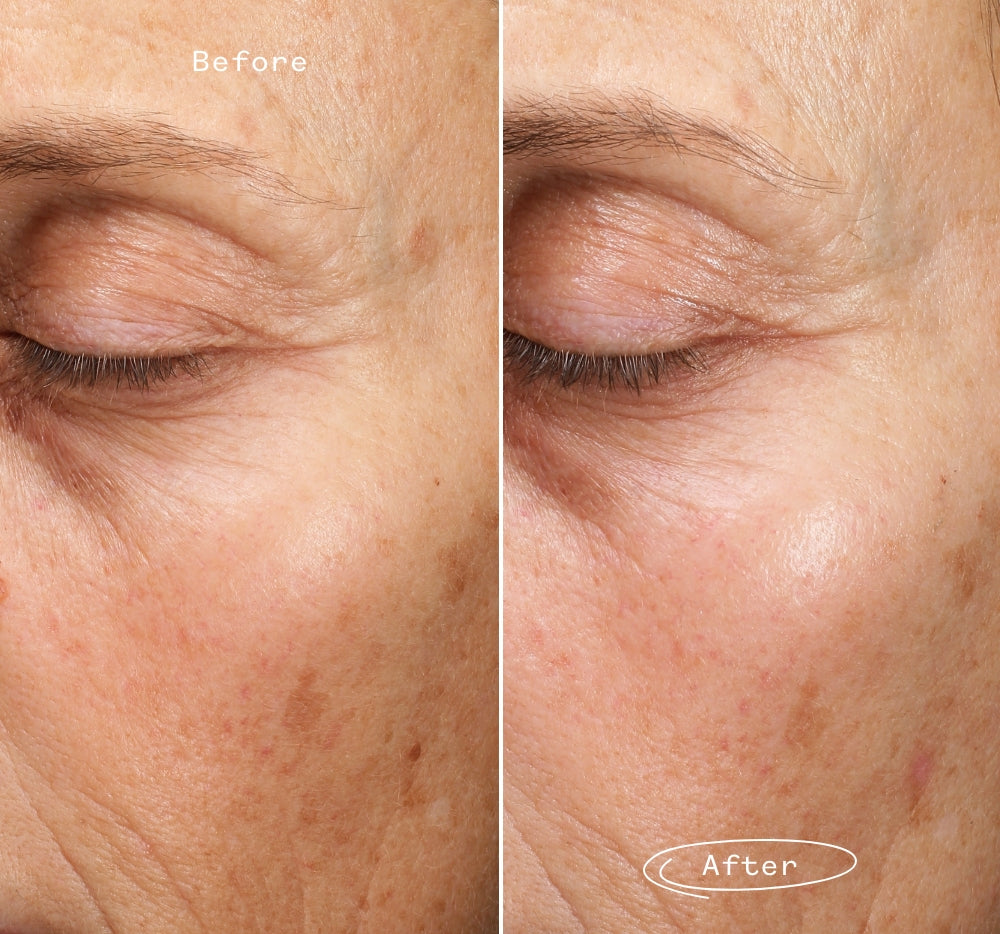 Fade Forward™ Dark Spot Serum for Sensitive Skin Pai Skincare