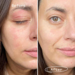 Pai Skincare Feather Canyon eye cream before & after