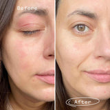 Pai Skincare Feather Canyon eye cream before & after